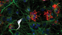 Formation of 3-D, functional neuronal networks in vitro