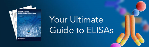 Your Ultimate Guide to ELISAs